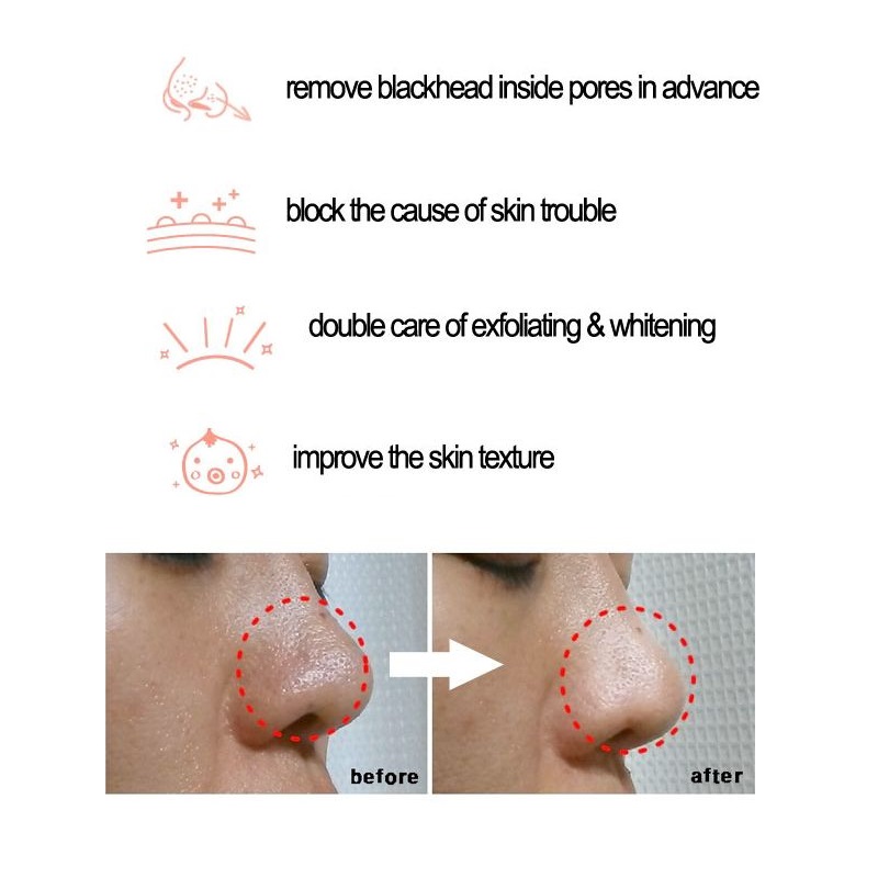 Cosrx BHA Blackhead Power Liqu - Skincare Cosrx ulasan dan harga